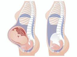 妊婦の骨盤